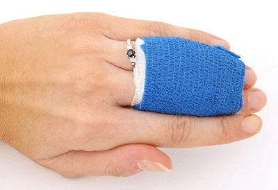 How to effectively treat a fracture before you get medical help