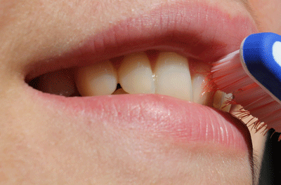 what to do when someone has a mouth or dental injury